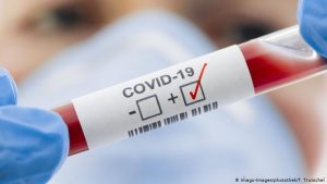 Por que a taxa de mortalidade por coronavírus é mais baixa na Alemanha?