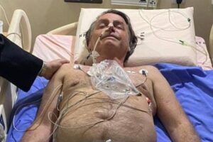 Com obstrução intestinal, Bolsonaro é transferido a São Paulo para possível cirurgia de emergência; Folha de São Paulo